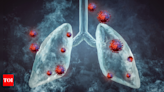 Recognizing lung cancer: Comprehensive guide on symptoms, diagnosis, treatment, and prevention - Times of India