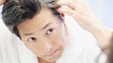 Everything You Need to Know About Getting a Hair Transplant