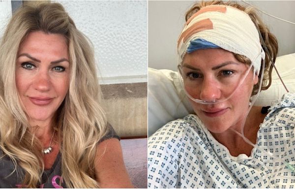 Woman, 43, reveals first symptom of her 'golf ball-sized' brain tumour