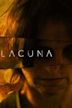 Lacuna