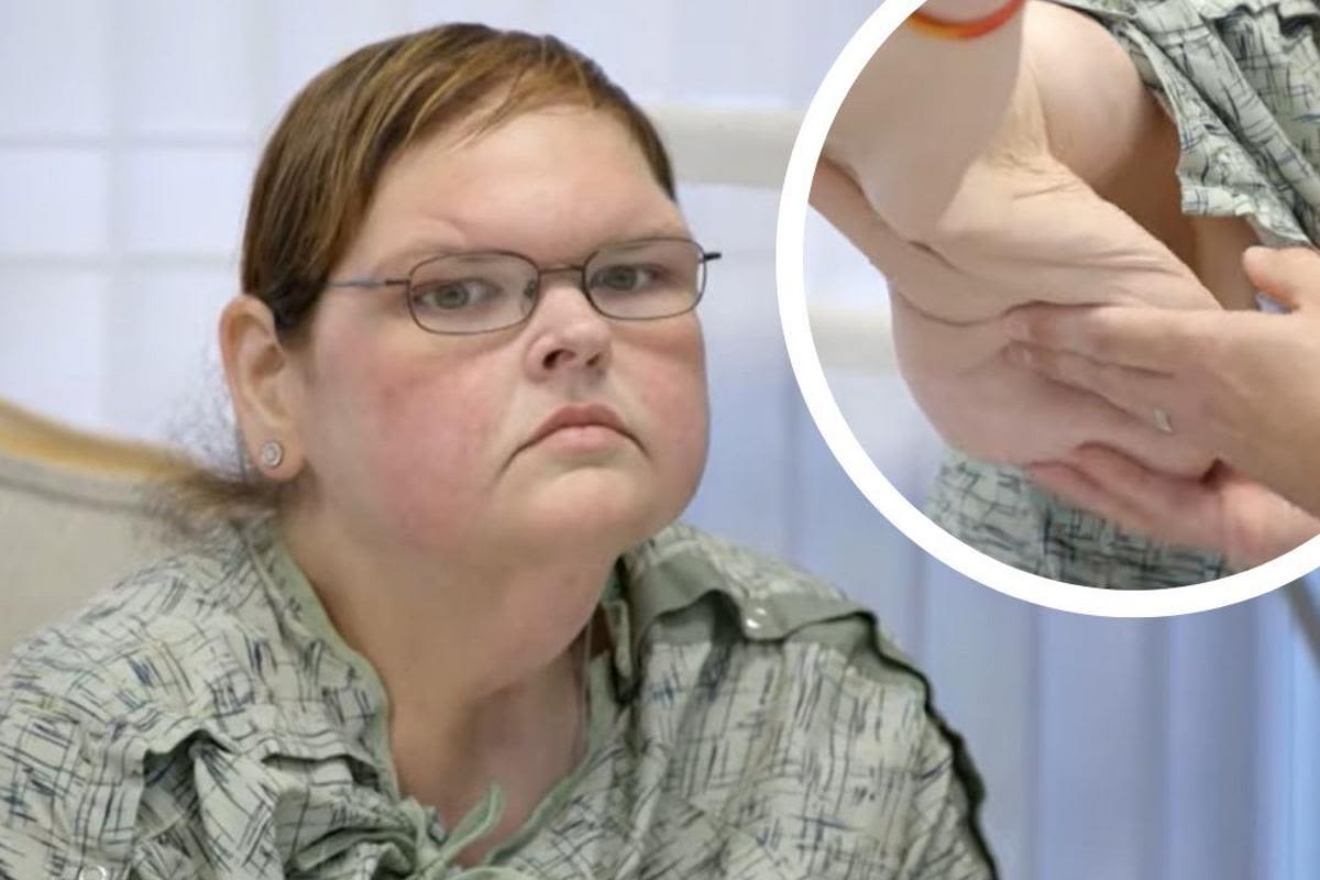 '1000-Lb. Sisters' Star Tammy Slaton Is 'Afraid' but Ready for Loose Skin Removal Surgery