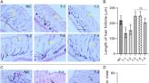 Cure for male pattern baldness given boost by sugar discovery