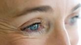 Best Ways To Treat And Prevent Fine Lines Around Your Eyes