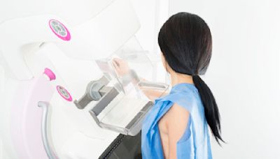 乳癌就一定要手術全乳切除？8 類乳癌高危群體需警惕！