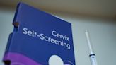 Outdated cancer screening guidelines jeopardizing early detection, doctors say