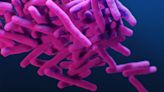 Tuberculosis outbreak declared public health emergency in California, but overall risk remains low