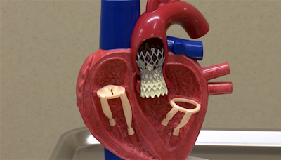 YRMC celebrates 10th anniversary of its lifesaving TAVR procedure - KYMA