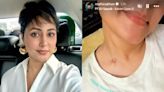 Hina Khan Bravely Shows Her Scars From Chemotherapy: ‘Good Things Coming’