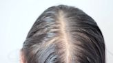 The Best Supplements For Mild To Moderate Hair Loss Over 40, According To Experts