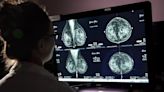 Cancer rates up among younger people, death rates higher among Black, ethnic minorities: report
