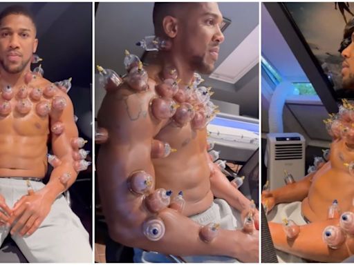 Anthony Joshua leaves boxing fans wincing after posting footage of 'hot cupping' treatment