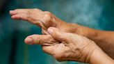 Gout in the Thumb: Could Your Thumb Pain Be a Sign of Gout?