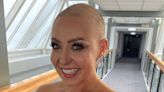 Amy Dowden couldn’t look in the mirror’ when she started losing hair following cancer treatment