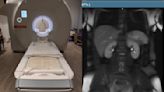 I got a full body MRI that cost $2,950 – here's what I thought