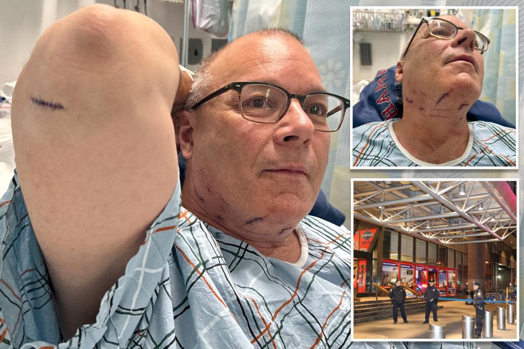 NJ dad of 3 randomly stabbed at Port Authority Bus Terminal received 46 stitches: ‘Thankful I’m still here’