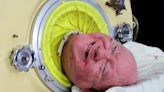 Paul Alexander, polio survivor who practised law despite living in an iron lung for 71 years – obituary