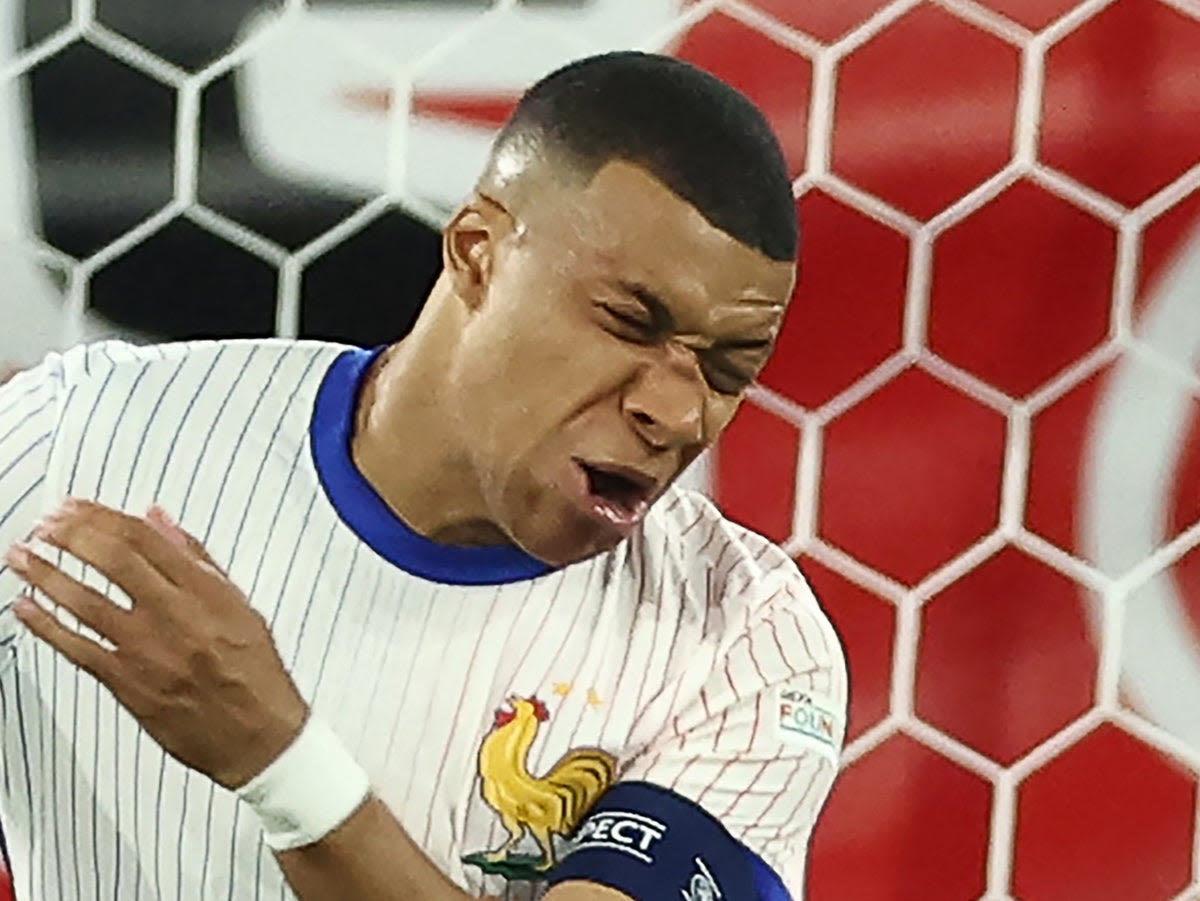 Kylian Mbappé injury latest as France provide update on broken nose