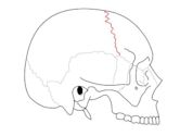 Coronal suture