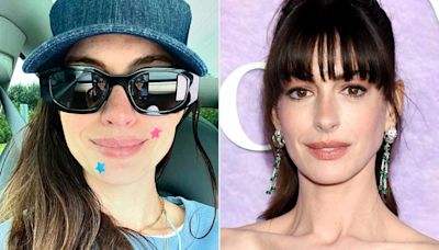 Anne Hathaway Wears Pimple Patches in Relatable Selfie: ‘Stars, They’re Just Like Us’