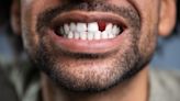 Medicine For Regrowing Teeth To Be Tested On Humans For The First Time