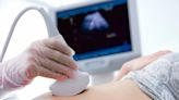 Samsung to acquire foetal ultrasound AI software company Sonio