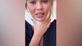 Chrissy Teigen reveals neck brace after headstand injury as star misses Met Gala
