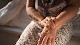 What to Know About Pannus and Rheumatoid Arthritis