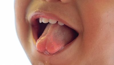 Saliva: qué es, para qué sirve, cuánta hay que tener y qué pasa si no producimos suficiente