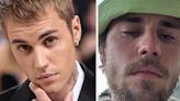 After Justin Bieber Posted Crying Selfies On Instagram, There's New Reports On His Mental Health