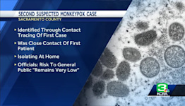 Second suspected monkeypox case identified in Sacramento County, health officials say