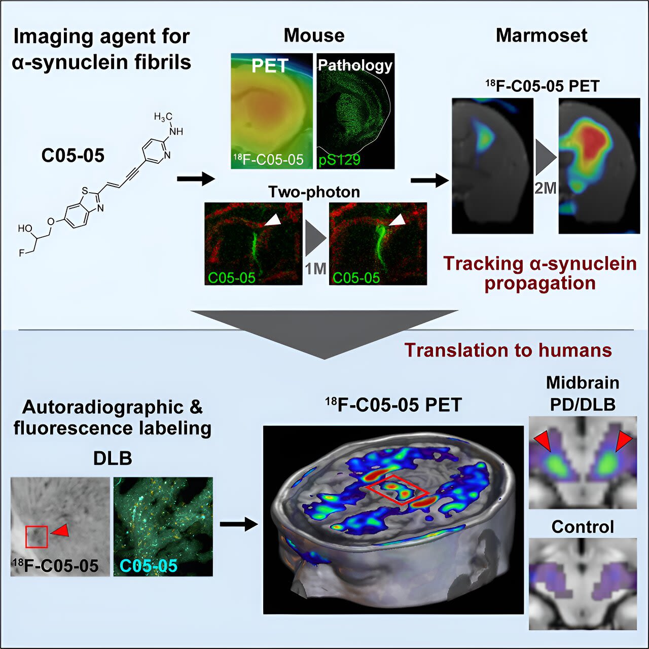 Visualizing core pathologies of Parkinson's disease and related disorders in live patients