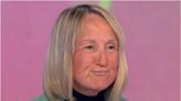 Loose Women’s Carol McGiffin addresses concern after face resembles ‘tomato’