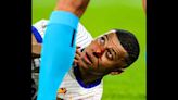 Euro 2024: France battle past tenacious Austria but Kylian Mbappe suffers facial injury