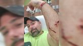 'Seemed like forever': DoorDash driver hospitalized after dog attack