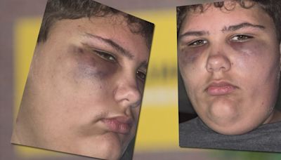 Bus driver no longer driving after student assaulted, beaten with belt during fight on bus