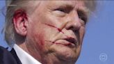 Atentado a Trump só falhou porque ex-presidente se moveu em palanque: 'Ele teria sido atingido na cabeça', diz especialista