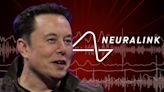 Elon Musk Says Brain Chip Patient Can Control Computer Mouse With Thoughts