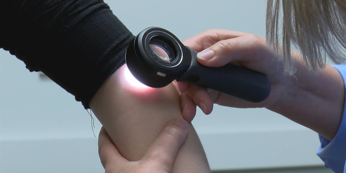 Melanoma numbers increasing in Missouri and Arkansas