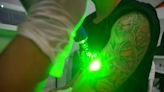 What You Need to Know About Laser Tattoo Removal Before Going Under the Beam