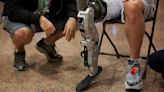 Desarrollan dispositivo capaz de "naturalizar" la conexión entre una persona y su prótesis