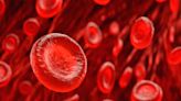 Innovative Thinking Could Make New Sickle Cell Treatments More Accessible