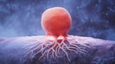 Carisma Therapeutics’ solid tumour therapy obtains FDA Fast Track status