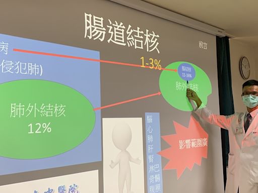 60歲男3度腸阻塞送急診 體重暴瘦10公斤 竟是這原因導致