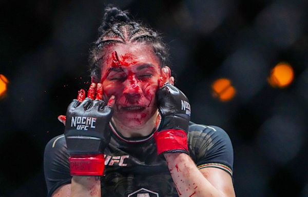 Norma Dumont unsurprised UFC 306 fight vs. Irene Aldana wasn't stopped – despite grotesque cut