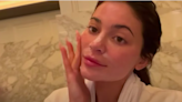 Kylie Jenner just shared how she got rid of a pimple for the Met Gala