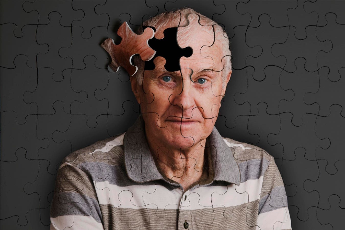 How To Prevent Alzheimer’s Disease: A Case For Vaccines