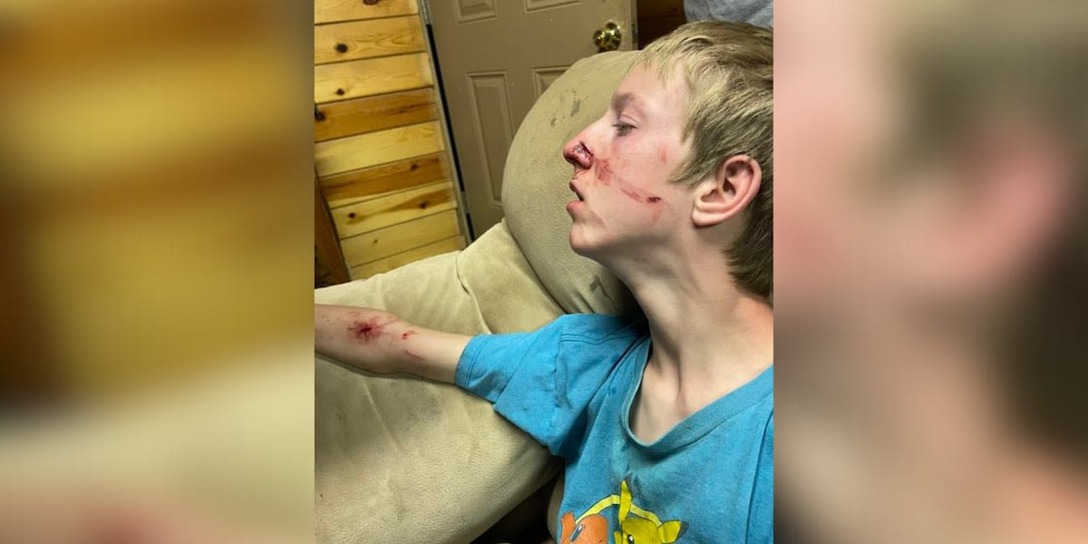 GRAPHIC: 15-year-old boy attacked by bear that got in family’s cabin