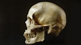Este cráneo se conservó en un panatano durante 5.000 años, con el arma homicida a su lado