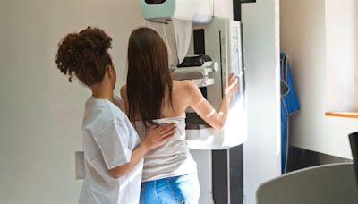 Mammograms should start at age 40, new guidelines recommend