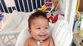 What is CHAOS? Baby With Rare Condition Survives Surgery Mid-Birth